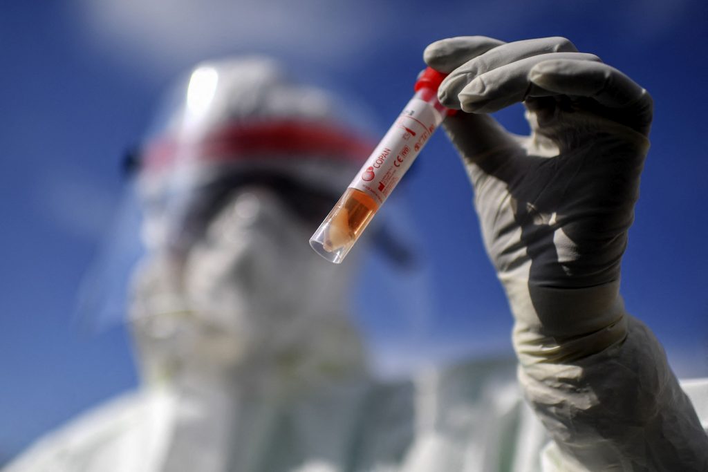 Medic care ține în mână un test COVID.