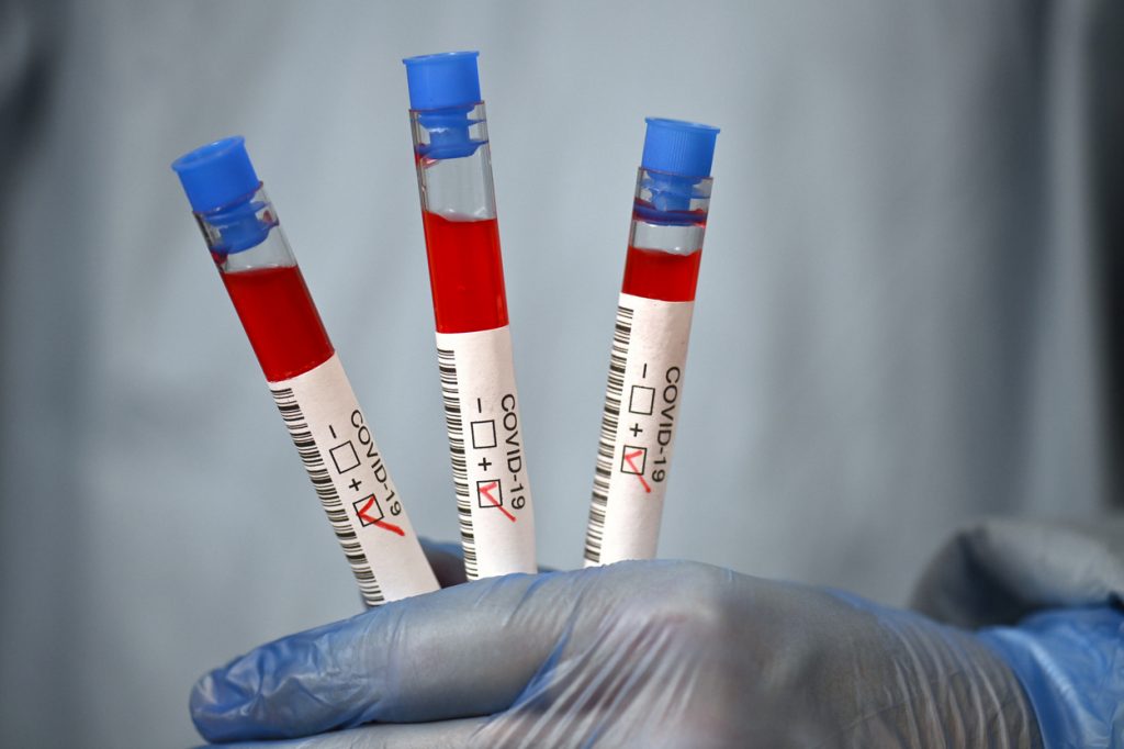 Asistentă care ține în mână teste COVID-19.