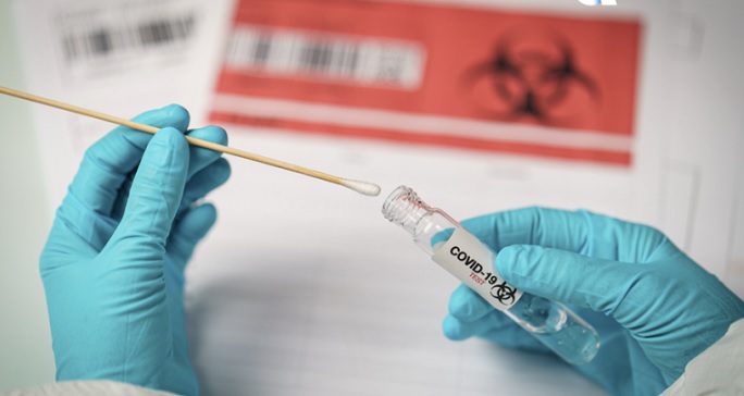 test nou covid china